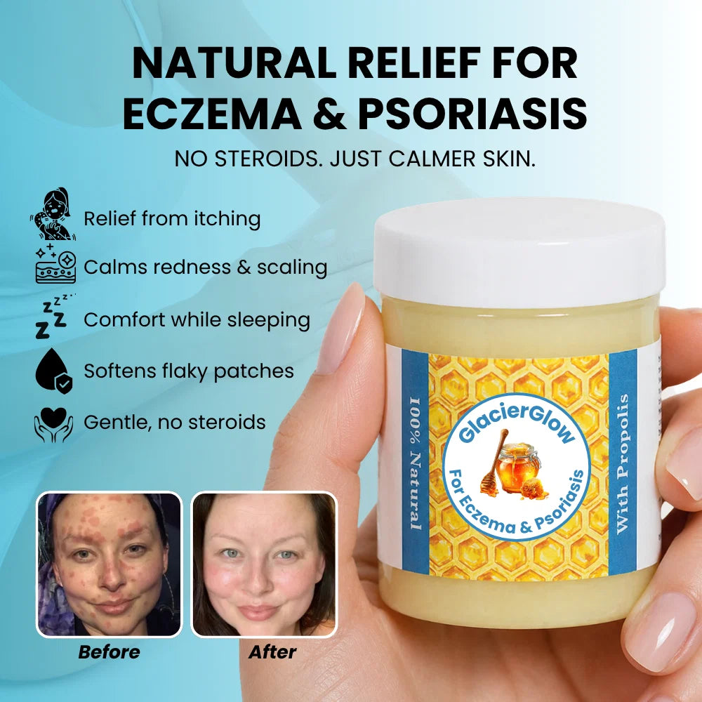 Hive & Heal - Repair Balm For Eczema & Psoriasis