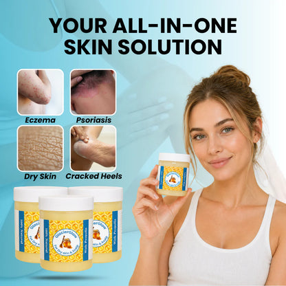 Hive & Heal - Repair Balm For Eczema & Psoriasis