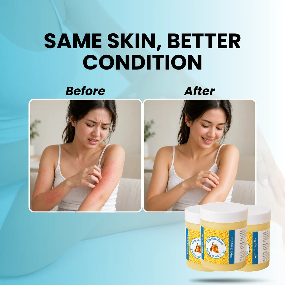 Hive & Heal - Repair Balm For Eczema & Psoriasis